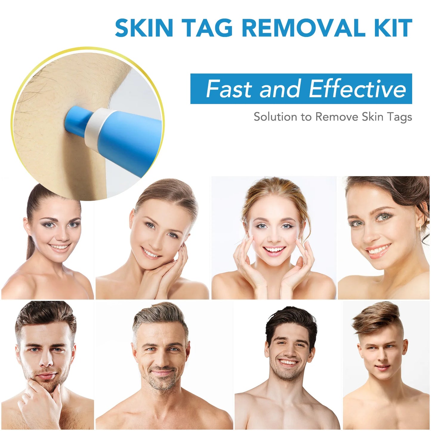 SmoothErase™ Skin Tag Solution