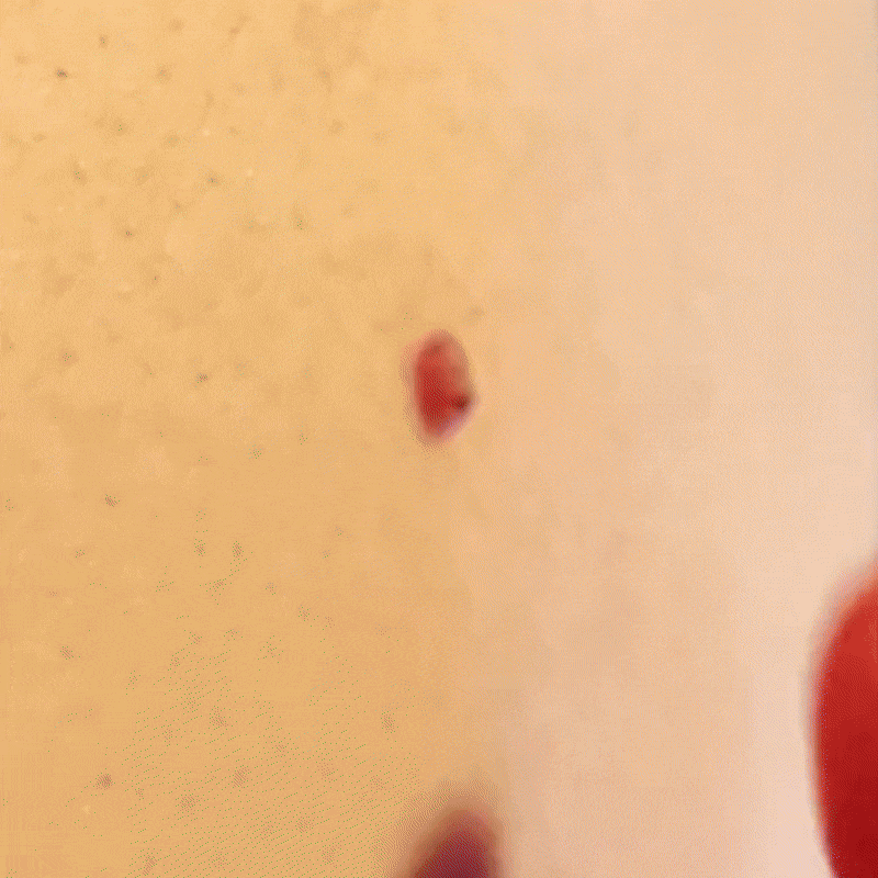 SmoothErase™ Skin Tag Solution