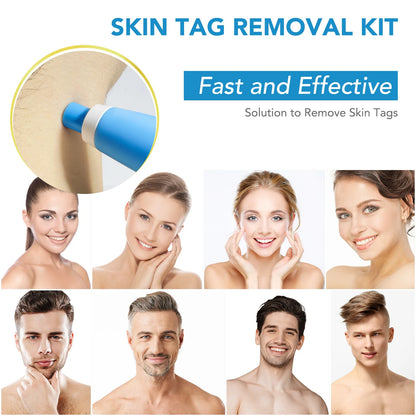 SmoothErase™ Skin Tag Solution