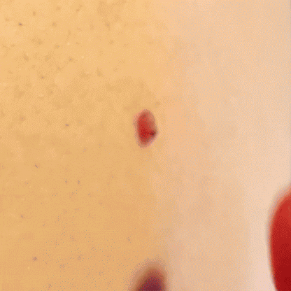 SmoothErase™ Skin Tag Solution