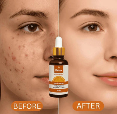Relax Vitamin C Daily Serum - 30ml